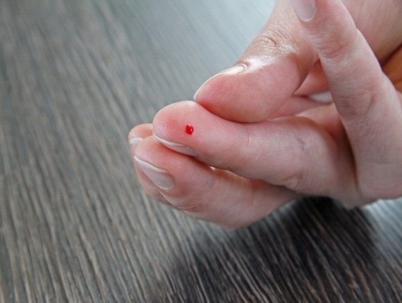 Der Bluttest kann mit einem Stich in den Finger durchgeführt werden.