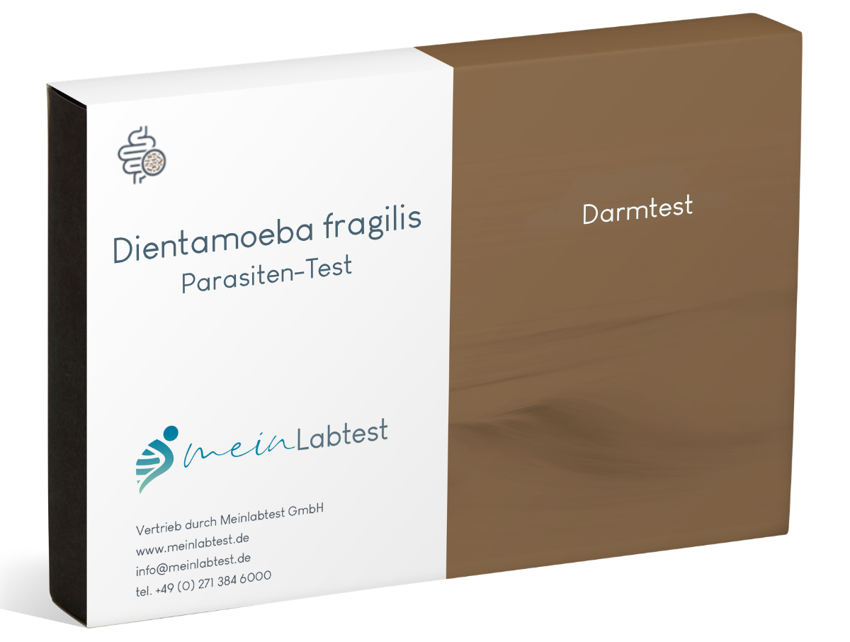 Dientamoeba-fragilis-Test