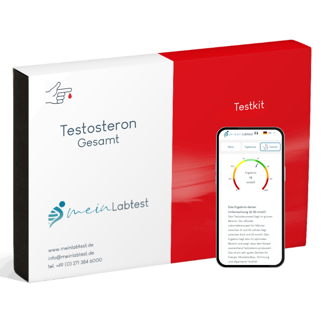 Der Testosterontest ist der einfachste Weg das Testosteronlevel zu bestimmen