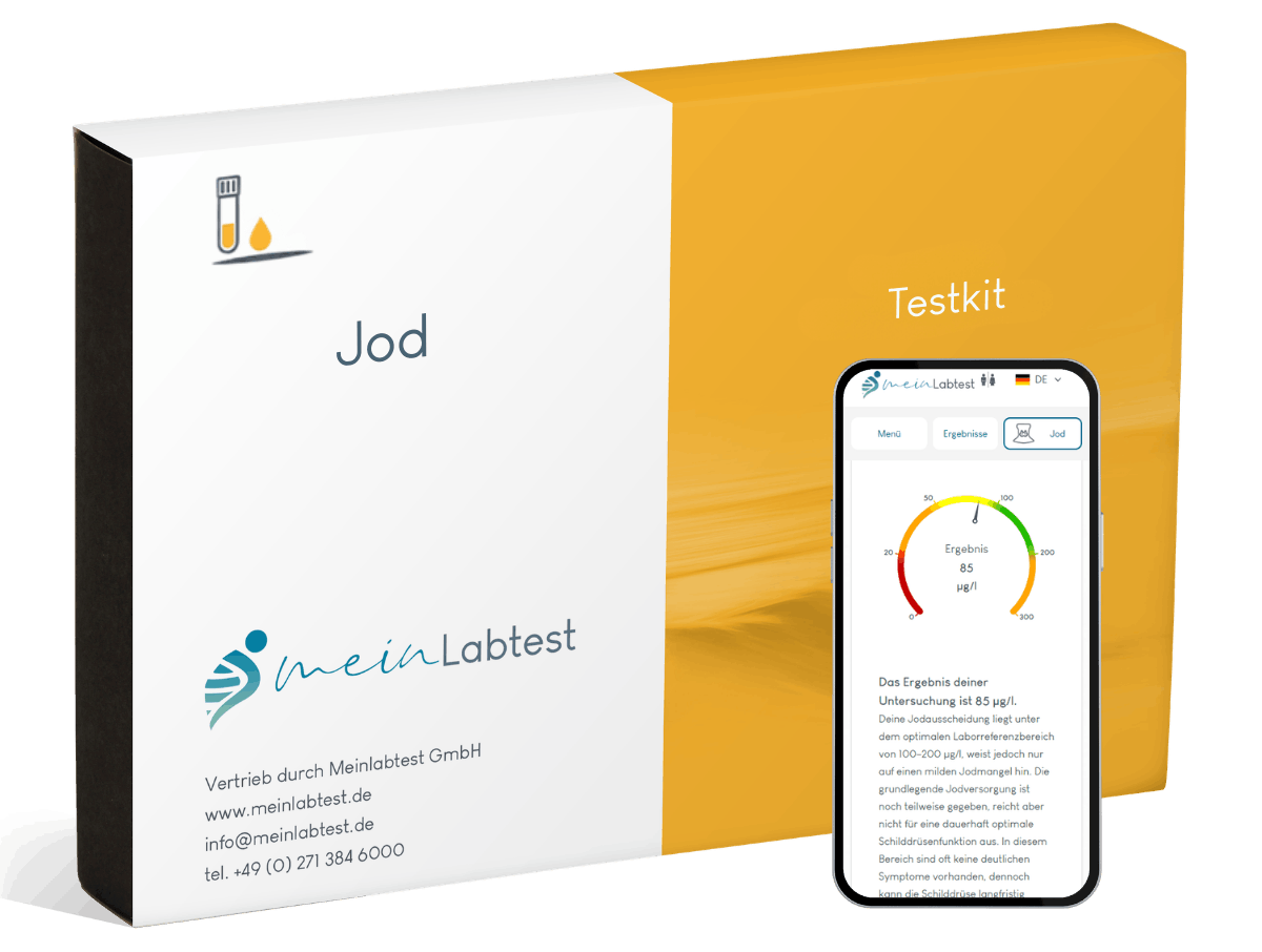 Jod-Urintest
