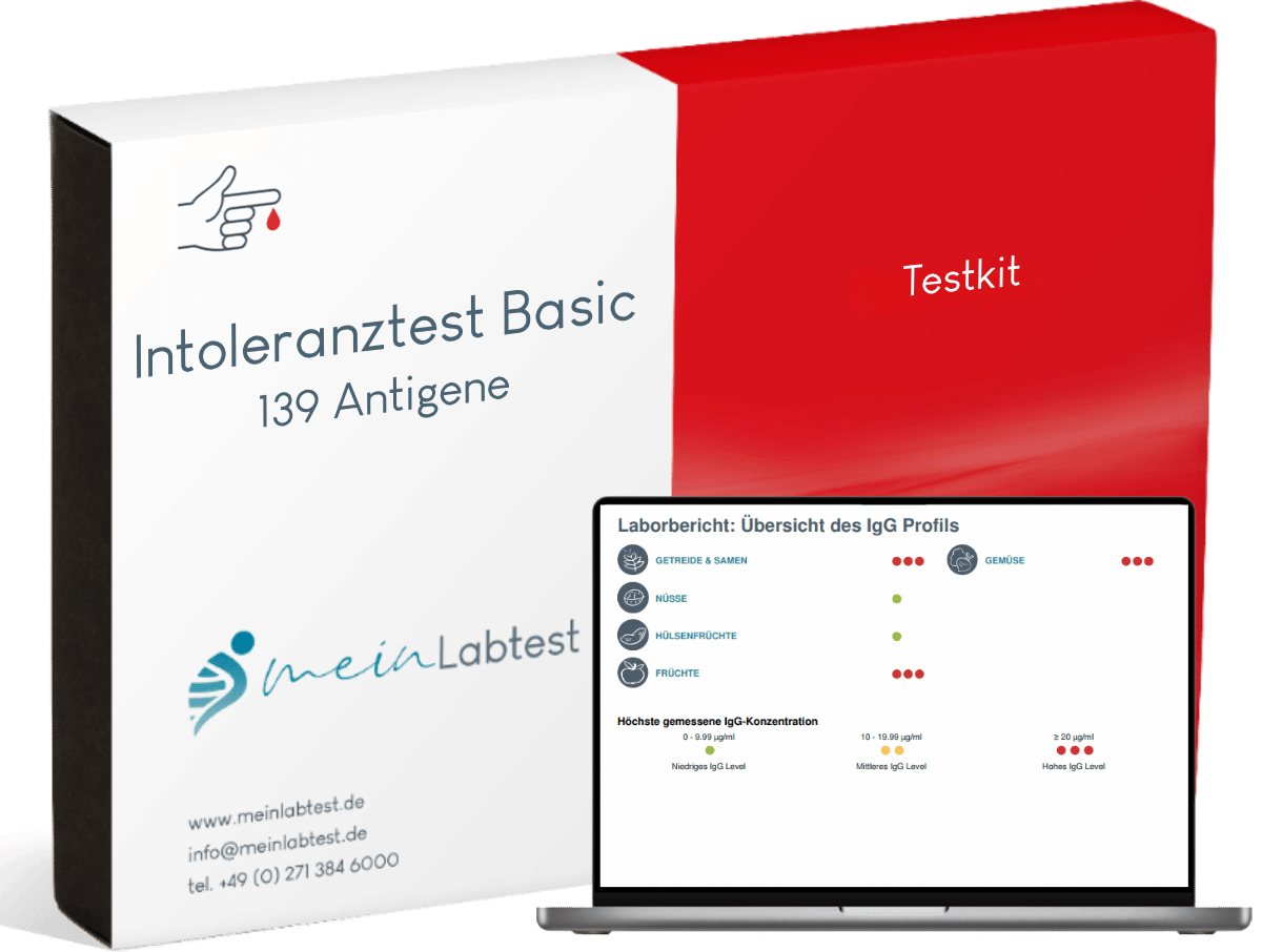 Der Lebensmittelunverträglichkeitstest Basic wird in diesem Karton geliefert