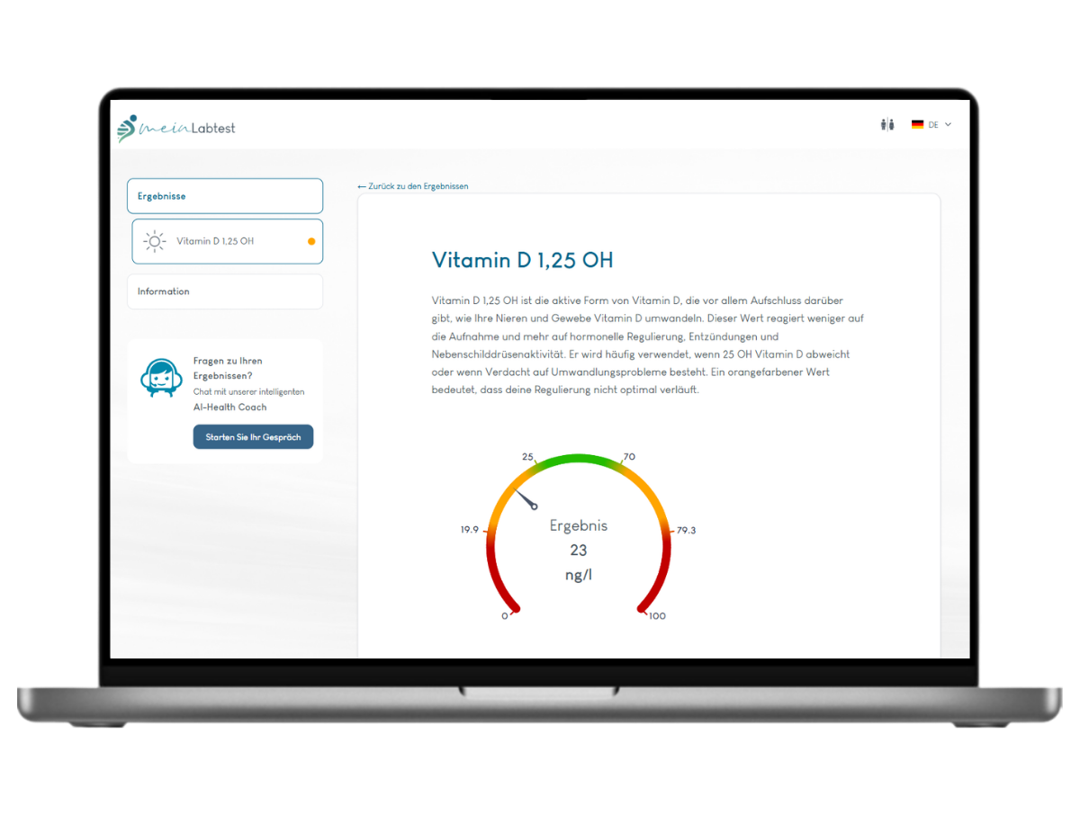 Beispiel des Vitamin D 1,25-OH Test Ergebnisses auf einem Laptop