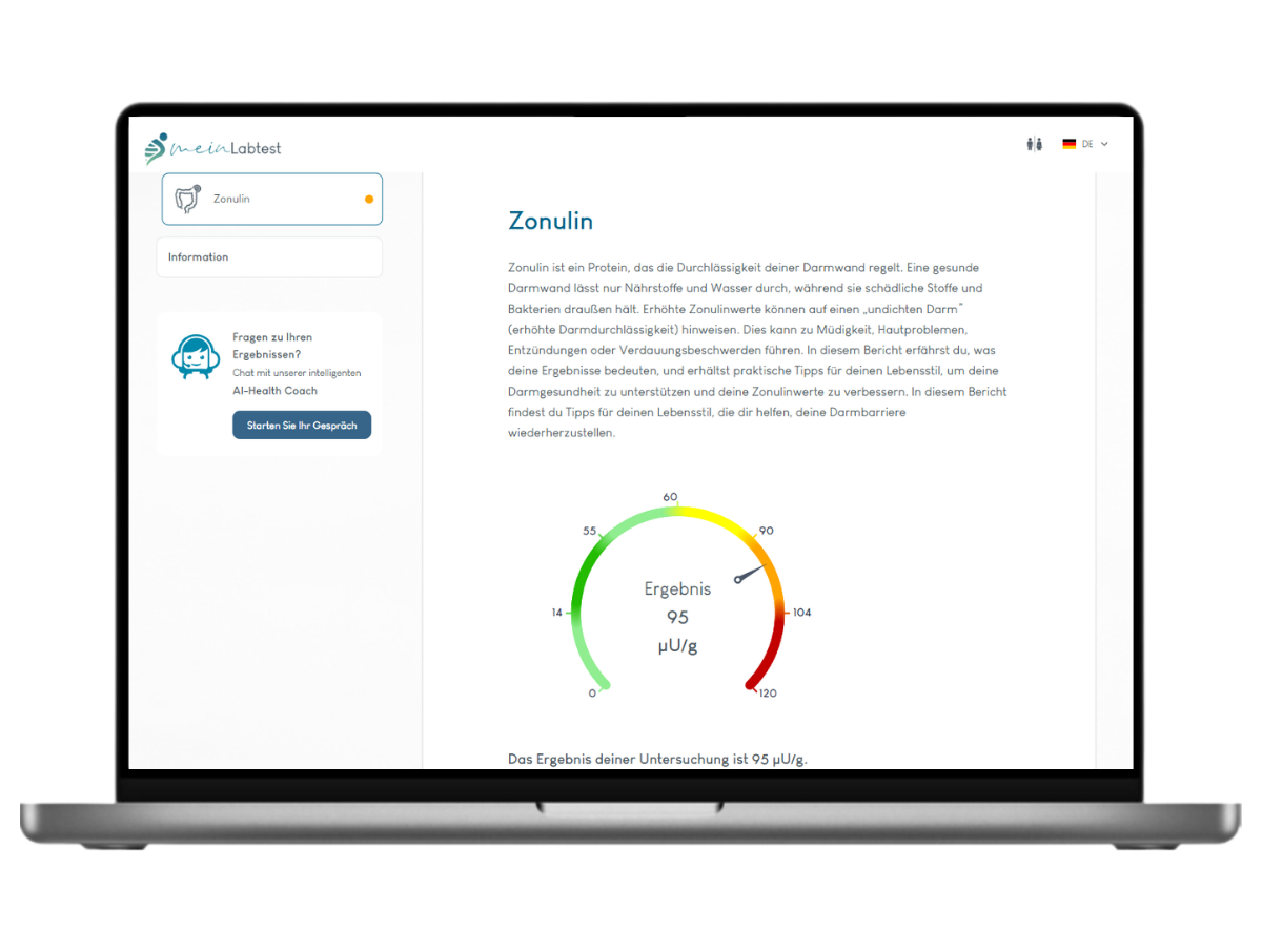Beispiel des Zonulin Test (Leaky-Gut) Ergebnisses auf einem Laptop
