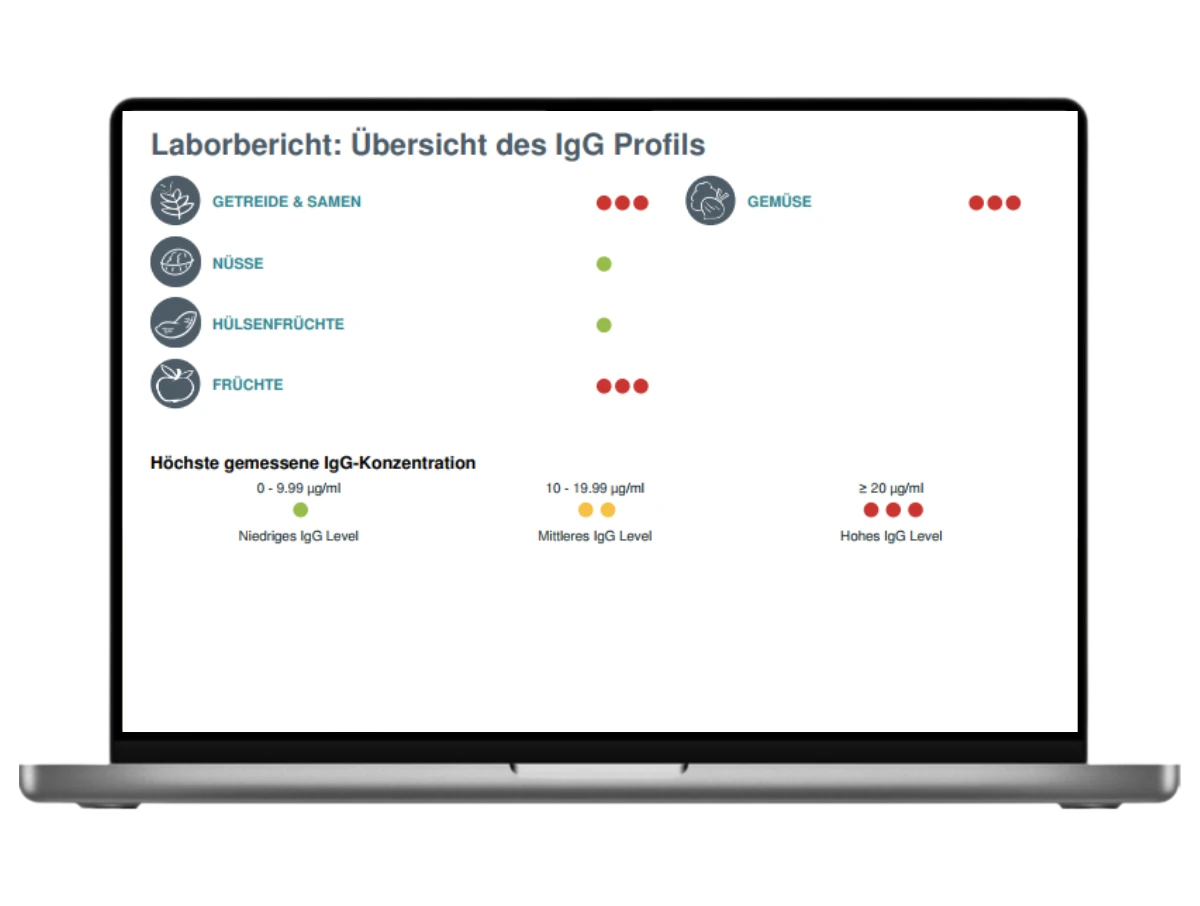 Ergebnisbericht des Lebensmittelunverträglichkeit-Tests Basic auf einem Laptop