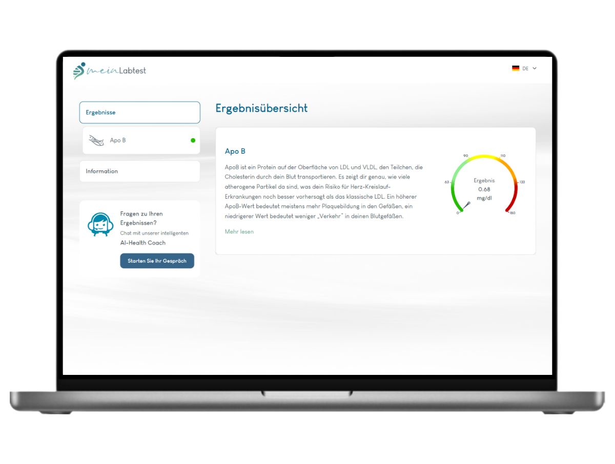 Beispiel des Apo B Test Ergebnisses auf einem Laptop