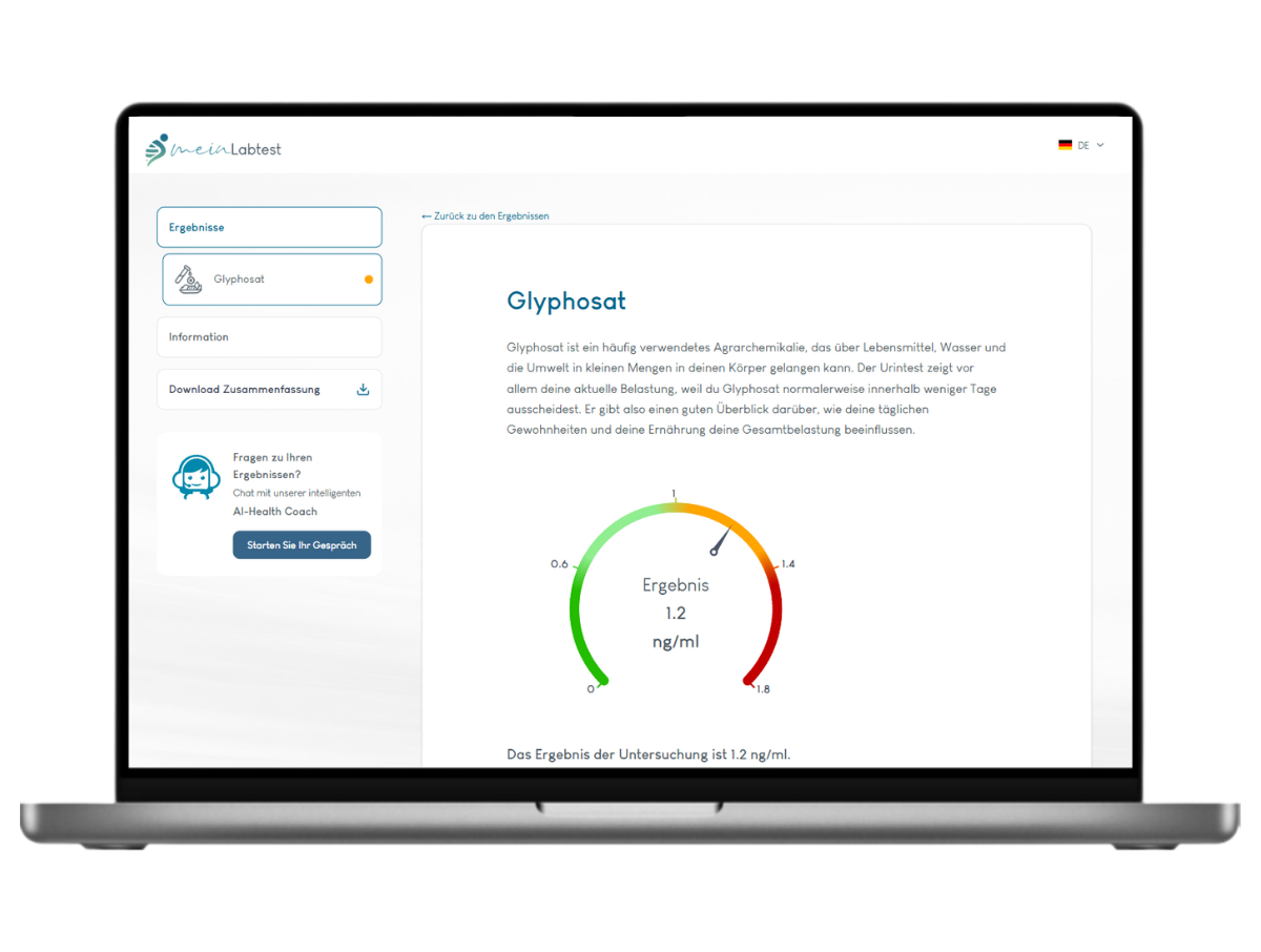 Beispiel des Glyphosat Test Ergebnisses auf einem Laptop