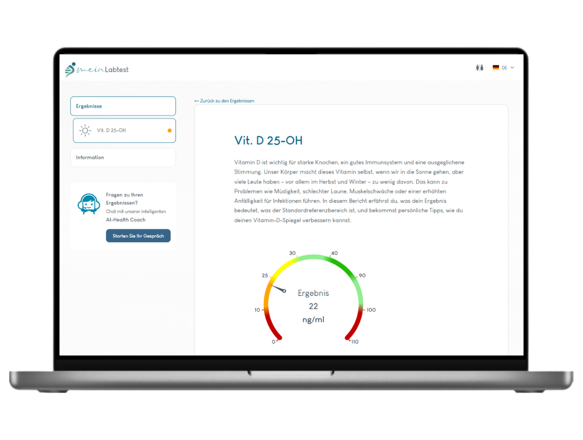 Beispiel des Vitamin D Test Ergebnisses auf einem Laptop