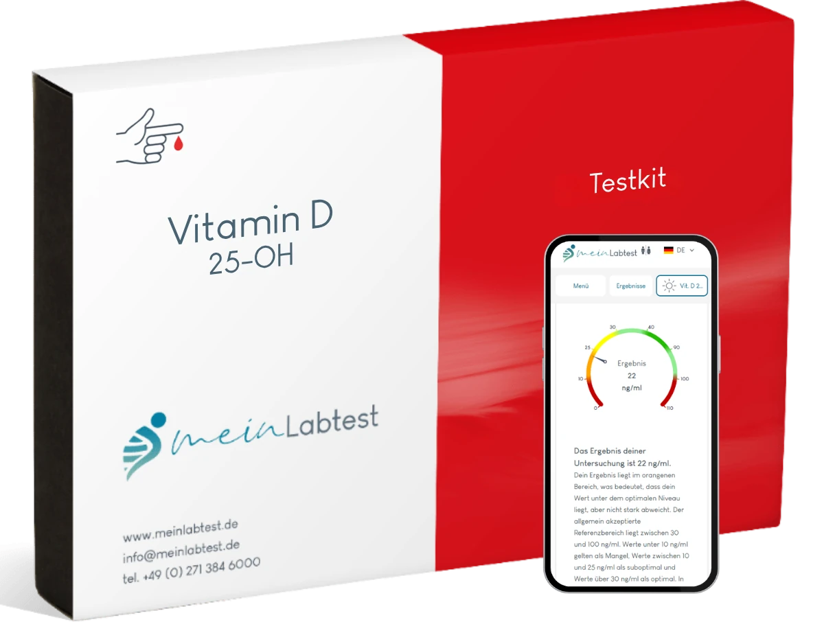 Vitamin D Test (25-OH)