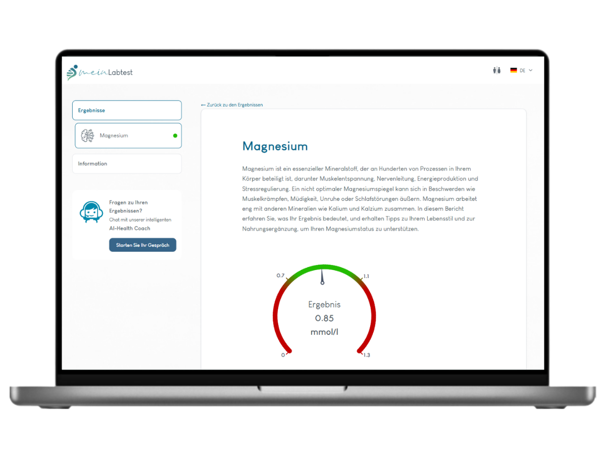 Beispiel des Magnesium Test Ergebnisses auf einem Laptop