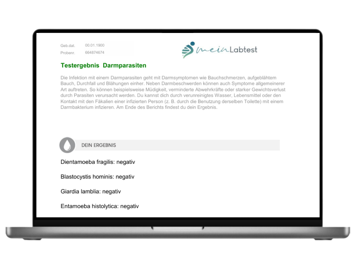 Beispiel des Cryptosporidium Test Ergebnisses auf einem Laptop