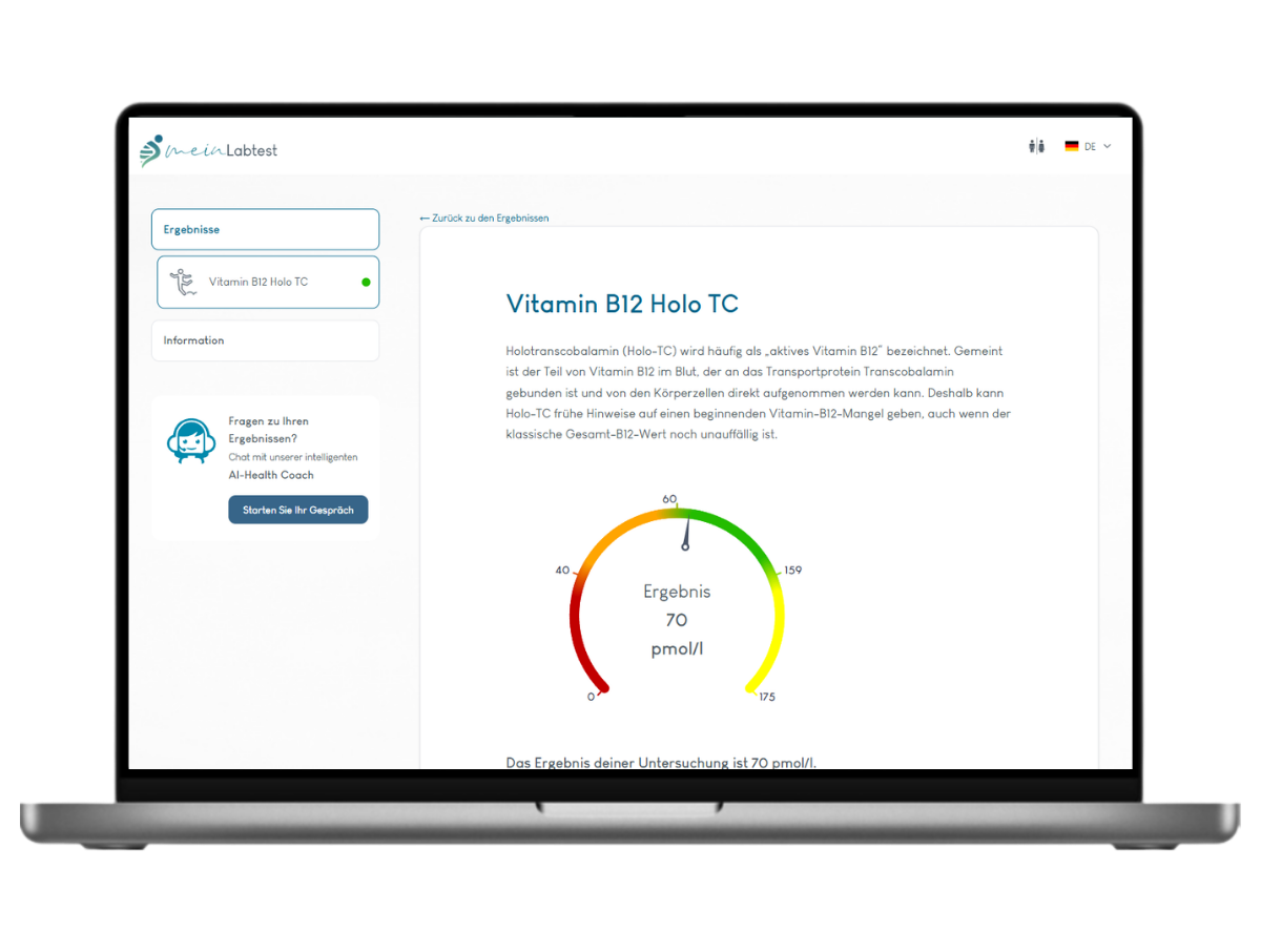 Beispiel des Vitamin B12 Holo-TC Test Ergebnisses auf einem Laptop