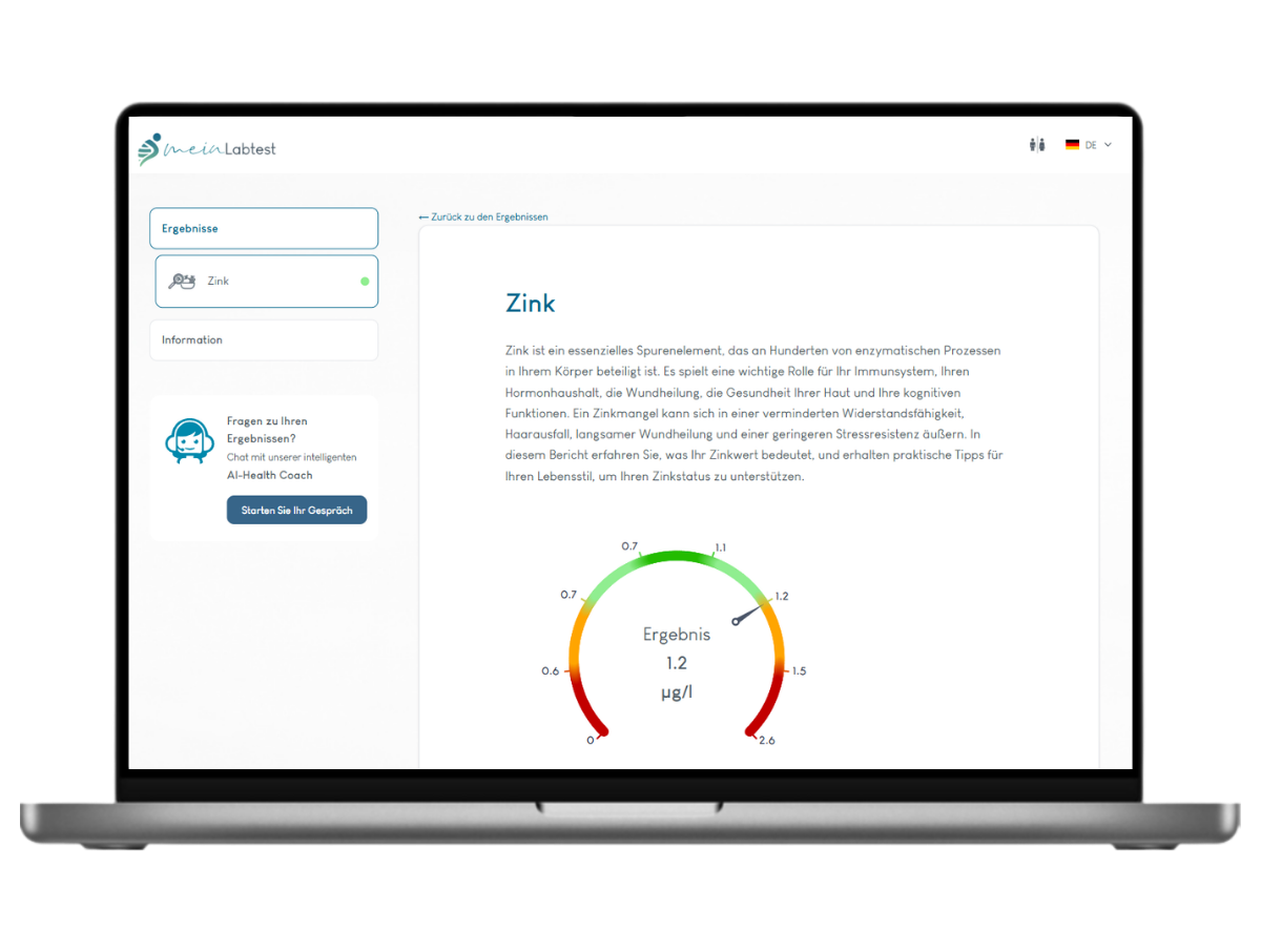 Beispiel des Zink Test Ergebnisses auf einem Laptop
