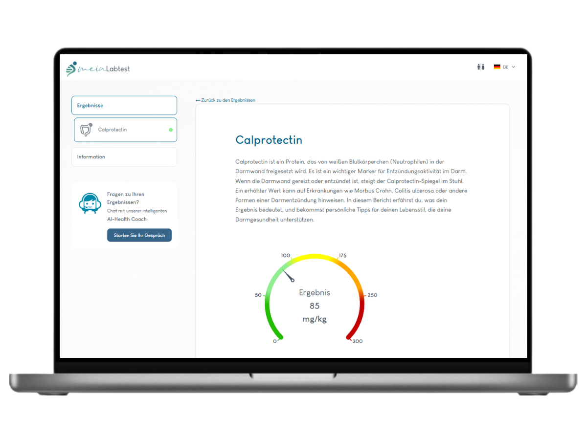 Beispiel des Calprotectin Test Ergebnisses auf einem Laptop