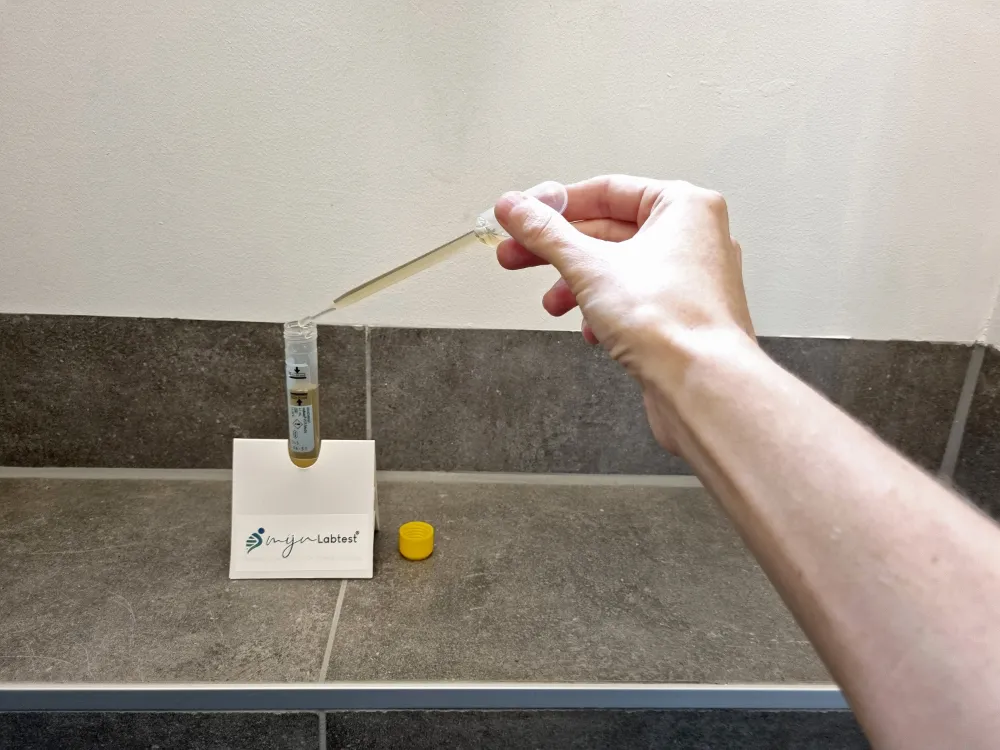 Nimm deine Probe für den Chlamydien-Test zu Hause ab