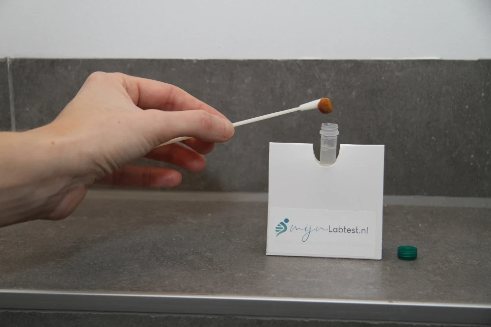 Nimm deine Probe für den Mikrobiom-Test zu Hause ab